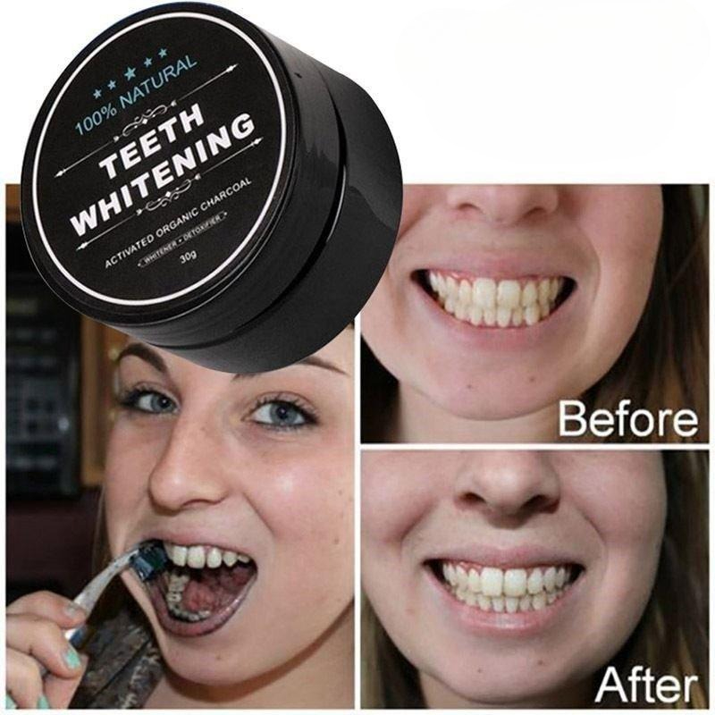 1 Box Activated Charcoal Teeth - Activated Charcoal Powder review and price